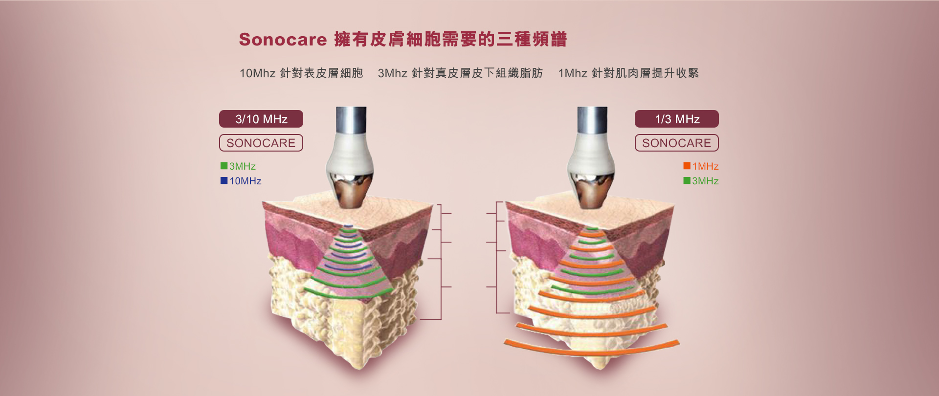 Sonocare 3種譜頻