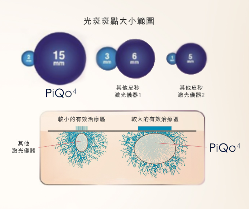 piqo4 雙脈衝技術 pic 1